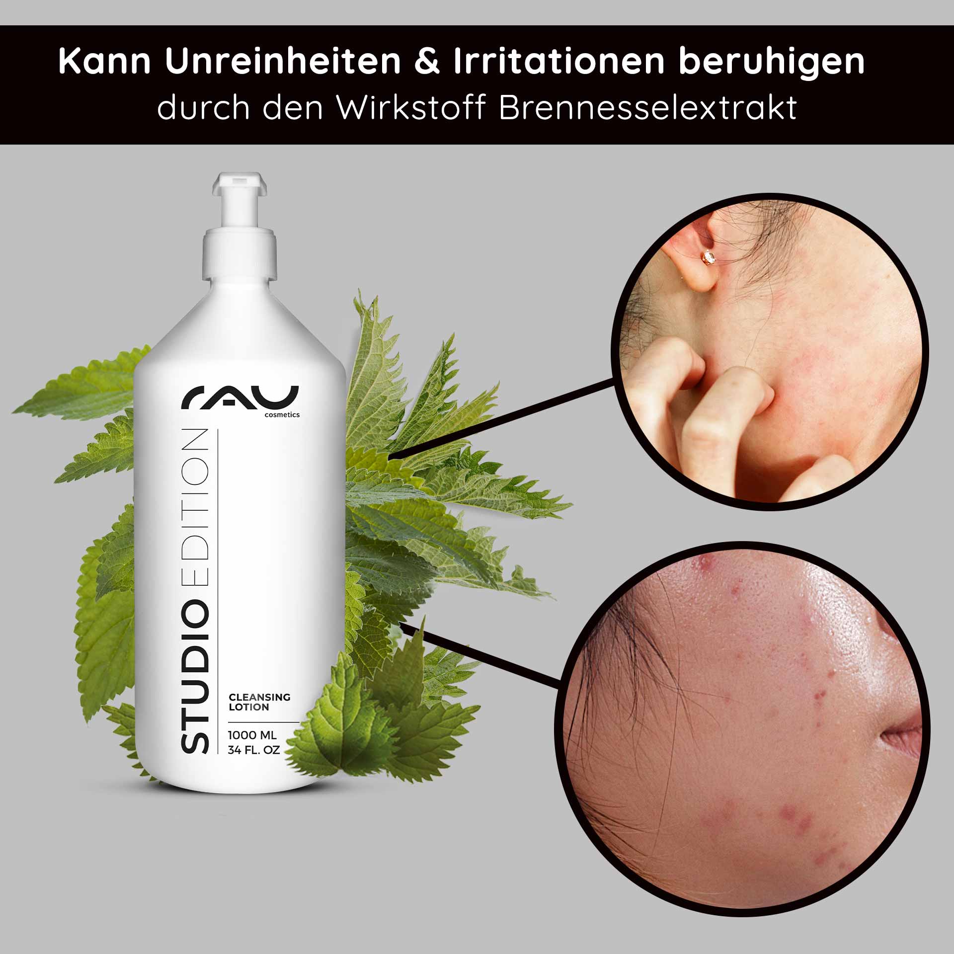 Lozione detergente 1000 ml Lozione detergente profonda Reinigungslotion-Flasche von RAU Cosmetics mit Brennnessel-Extrakt, umgeben von Brennnesselblättern, die die Vorteile zur Beruhigung von Hautirritationen und Unreinheiten hervorhebt und die natürliche Hautpflege betont.