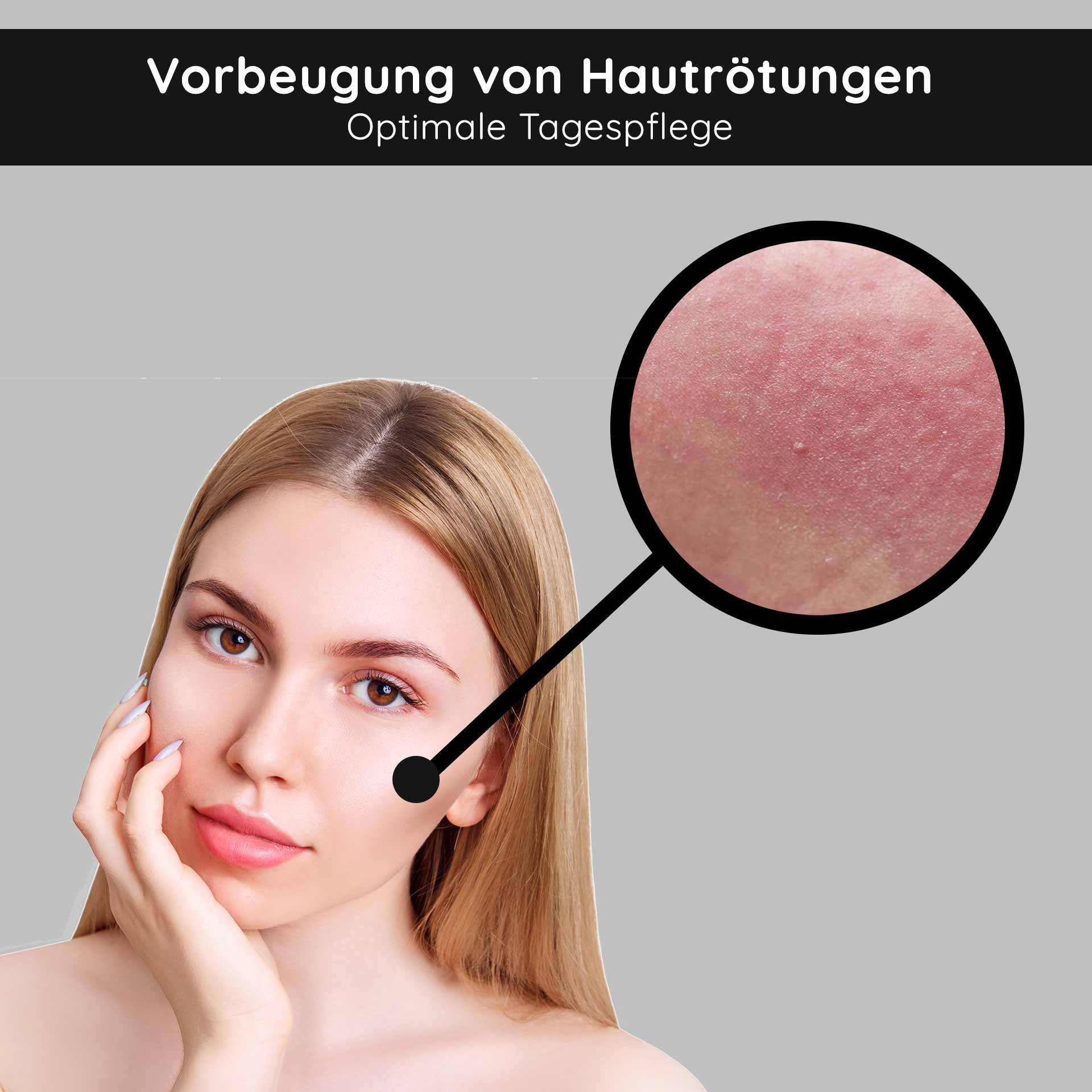 Donna dalla pelle liscia e lunghi capelli biondi, mostra arrossamenti cutanei in un'area ingrandita, sottolinea la cura da giorno ottimale per la prevenzione dei problemi della pelle.