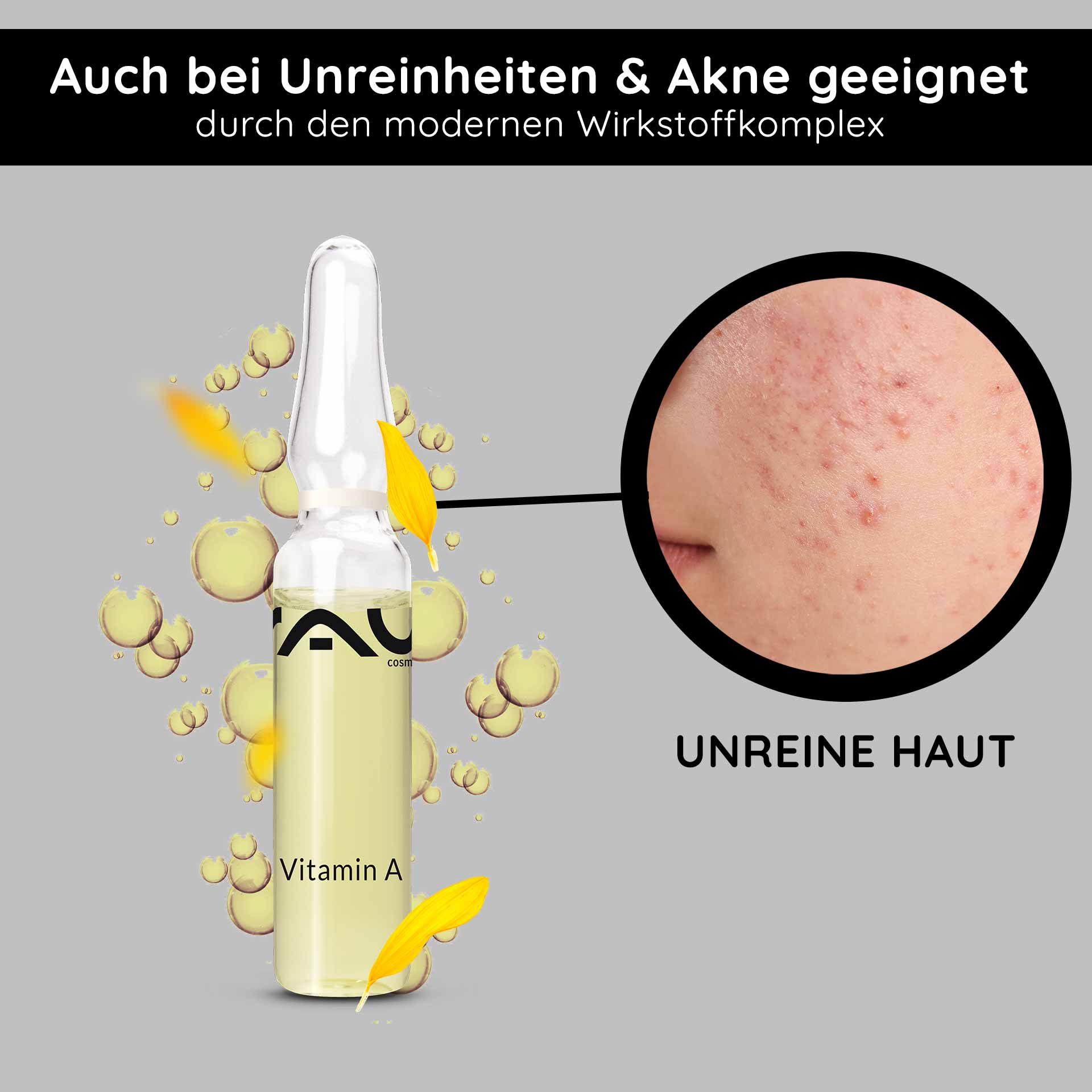 Ampolle di vitamina A 10x2 ml per pelli mature e con imperfezioni Ampulle mit Vitamin A von RAU Cosmetics, umgeben von Blasen, hervorgehoben für die Behandlung von unreiner Haut und Akne, mit dem Text "UNREINE HAUT" und gelben Blütenblättern.
