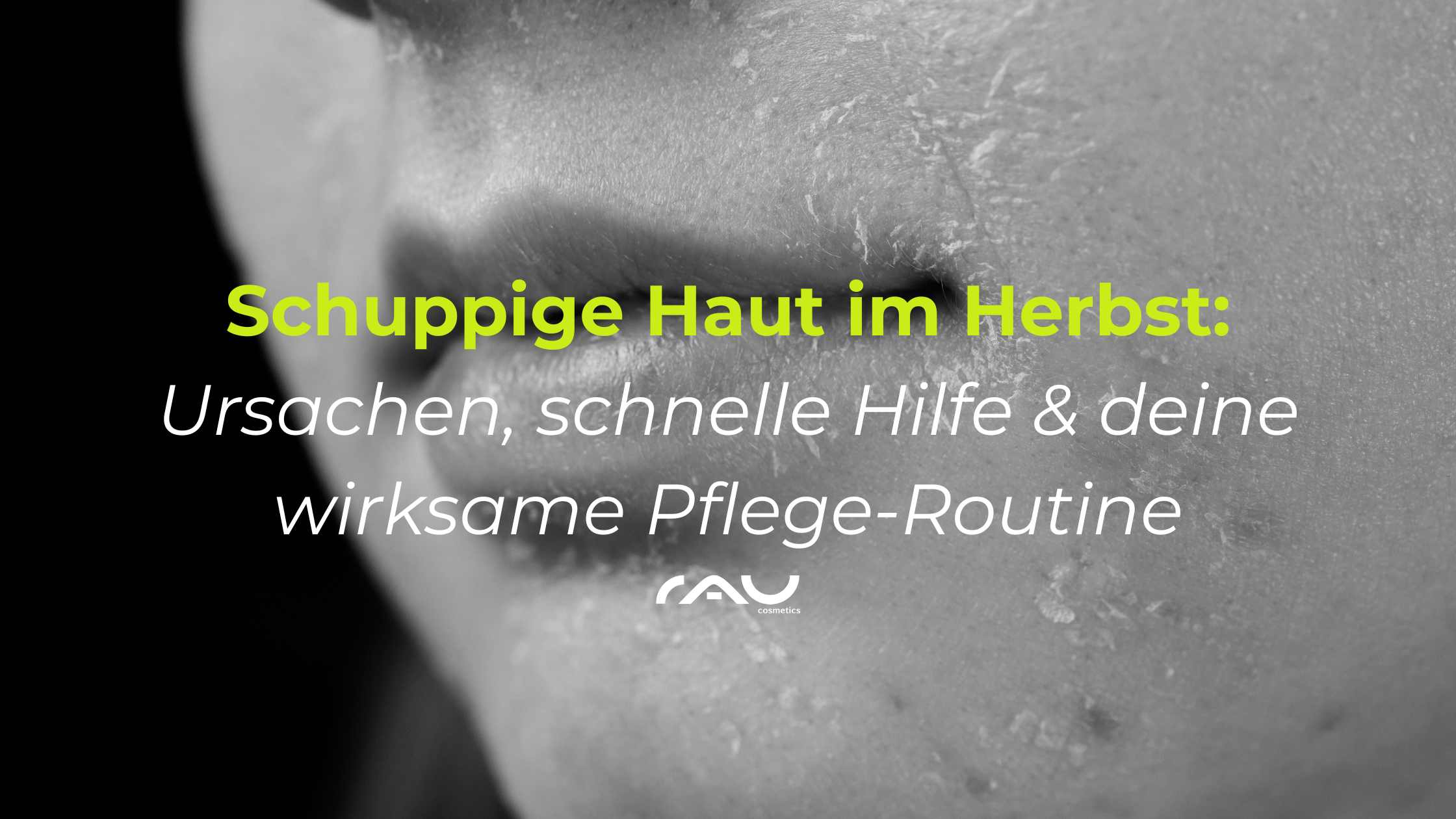 Schuppige-haut-blogpost Kopf, Person, Gesicht