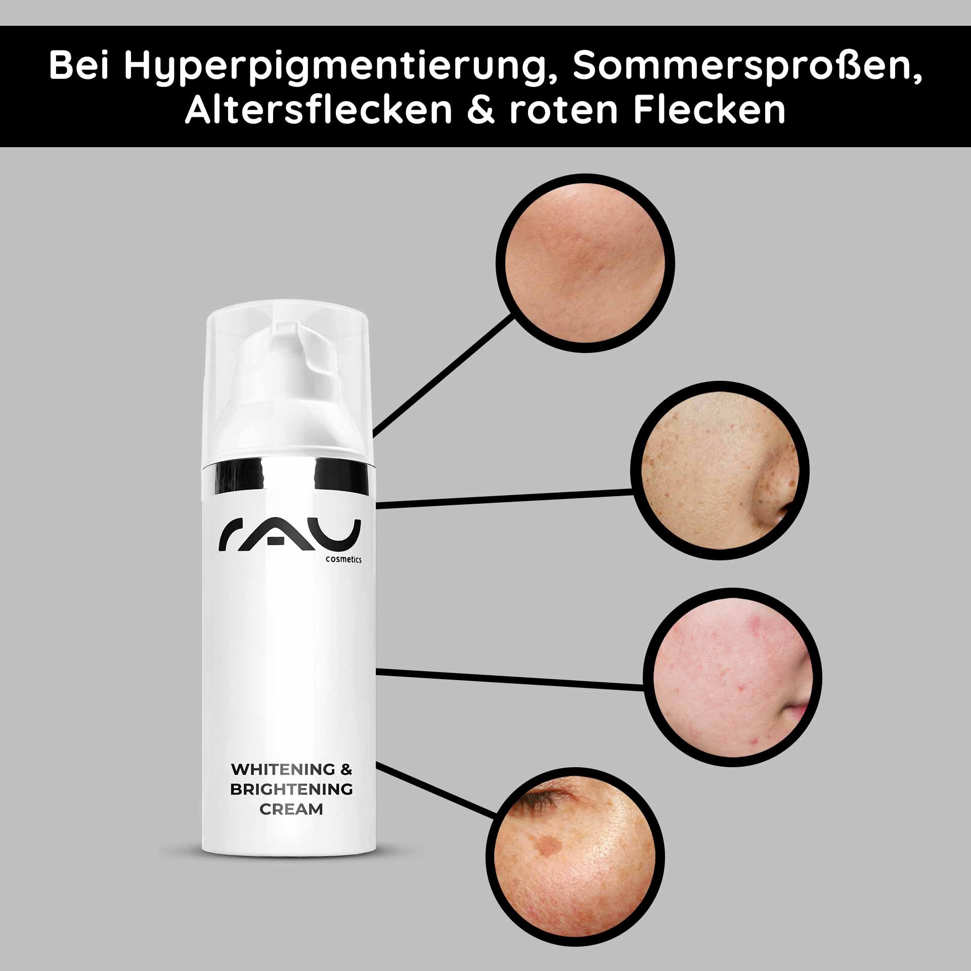 La Whitening & Brightening Cream di RAU Cosmetics evidenzia le imperfezioni cutanee come iperpigmentazione, macchie dell'età e macchie rosse e mostra soluzioni efficaci per lo schiarimento della pelle.