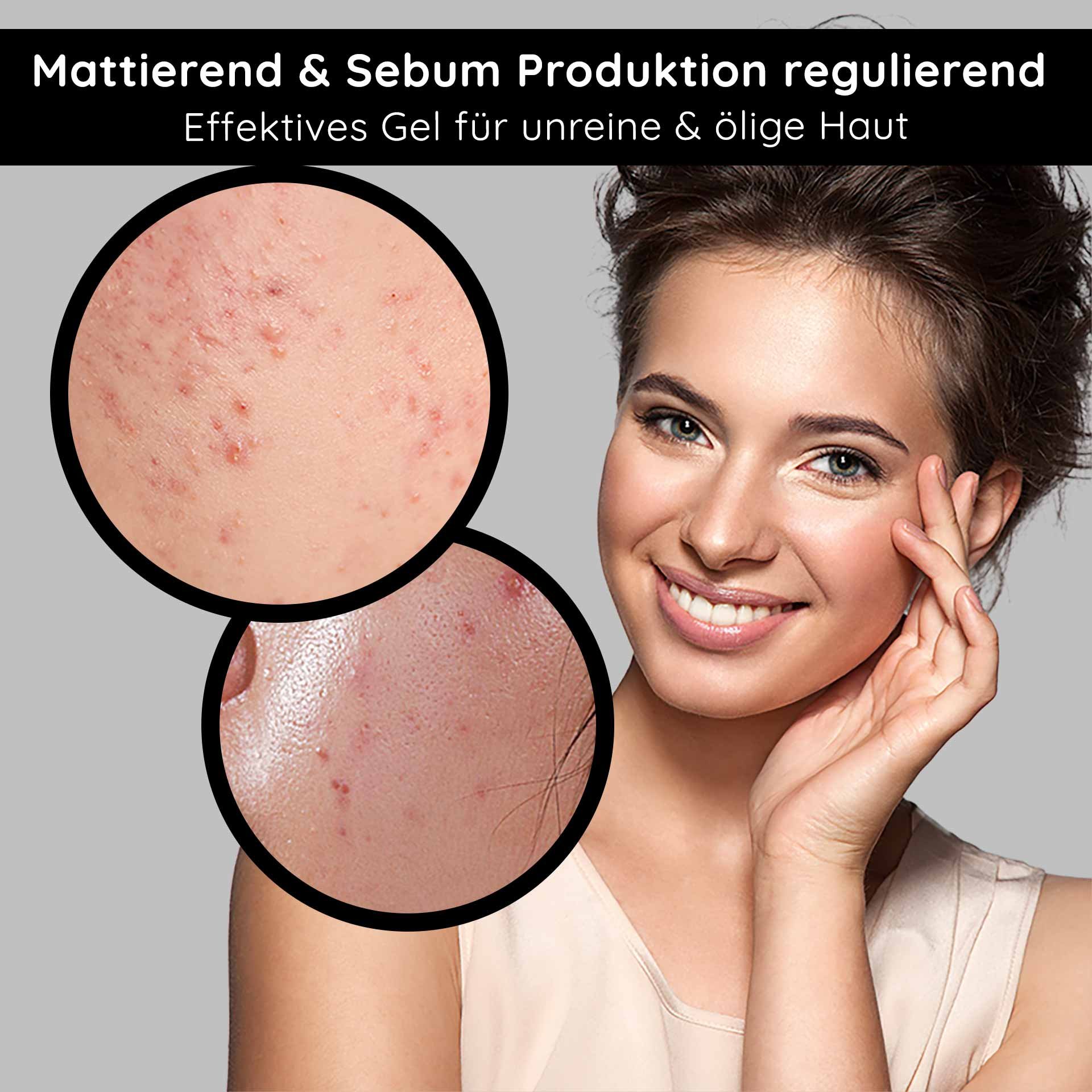 Gel opacizzante per pelle impura e oleosa, pori della pelle con impurità, donna sorridente con pelle sana, focus sulla cura della pelle e sulla regolazione del sebo.