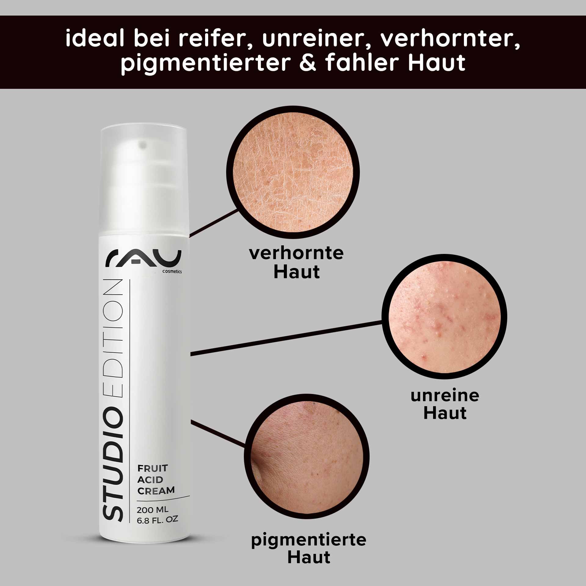 RAU Cosmetics Fruit Acid Cream Verpackung con hervorgehobenen Hautproblemen: verhornte, impura e pigmentierte pelle, ideal per reife e fahle pelle.