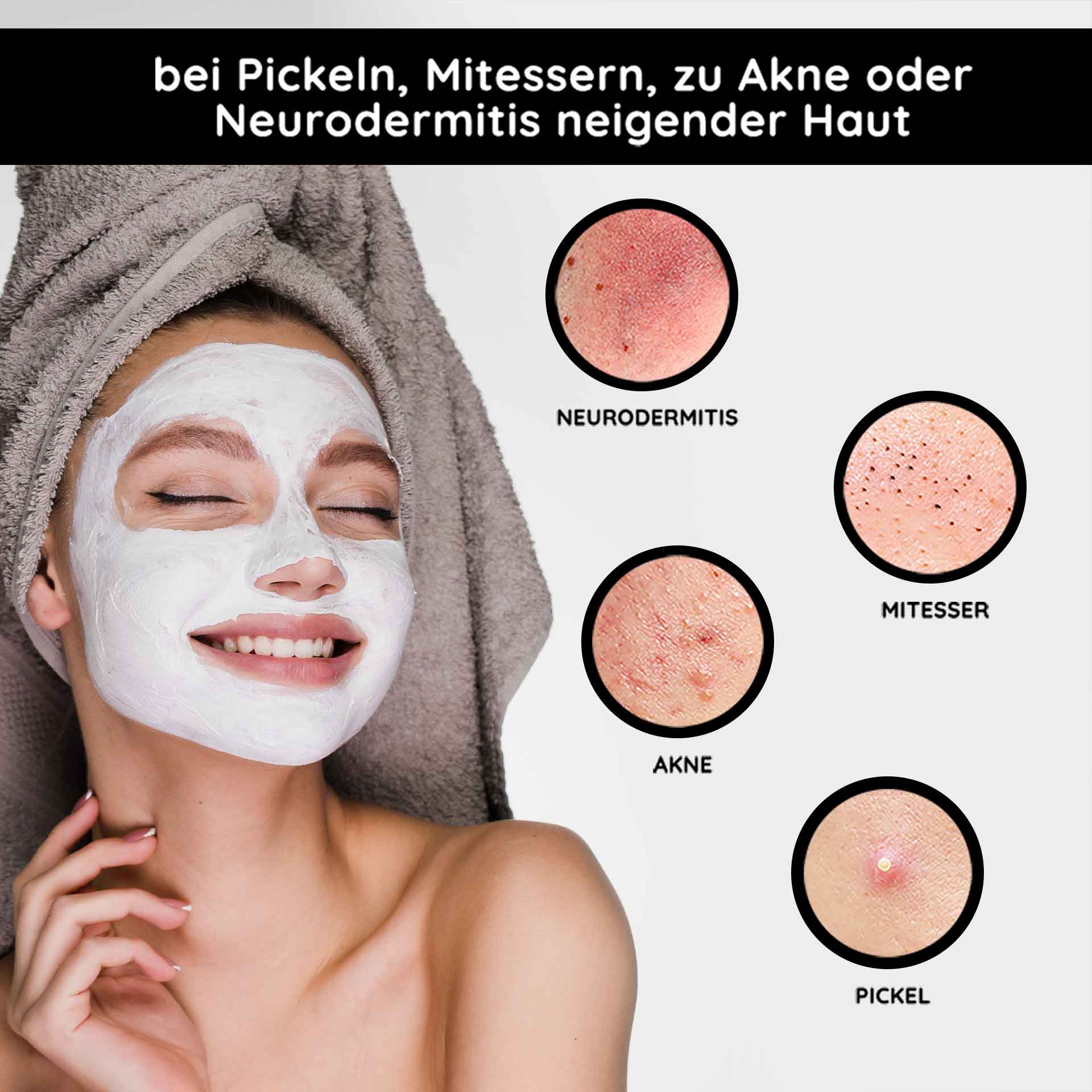 Maschera minerale 50 ml Maschera viso opacizzante Lächelnde Frau mit Gesichtsmaske zur Hautpflege, umgeben von Bildern von Hautproblemen wie Akne, Mitessern und Neurodermitis, präsentiert die Vorteile der RAU Cosmetics Mineral Mask für problematische Haut.