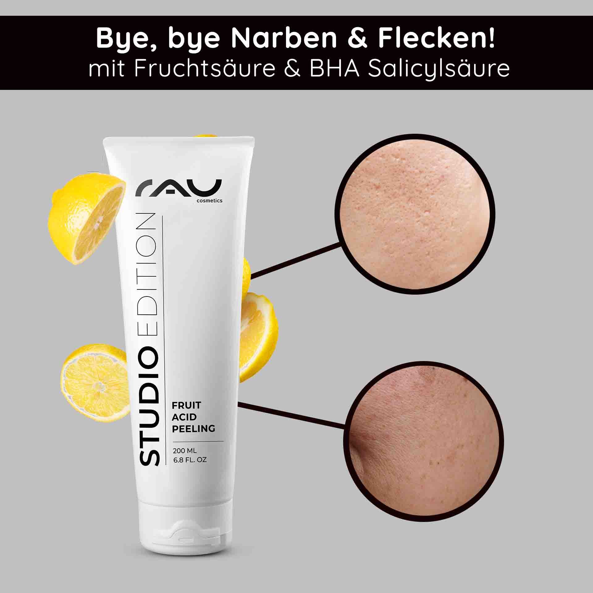 Tubo di RAU Cosmetics Fruit Acid Peeling con fette di limone, che evidenzia il miglioramento della struttura cutanea e i benefici dell'acido salicilico BHA per ridurre cicatrici e impurità della pelle.