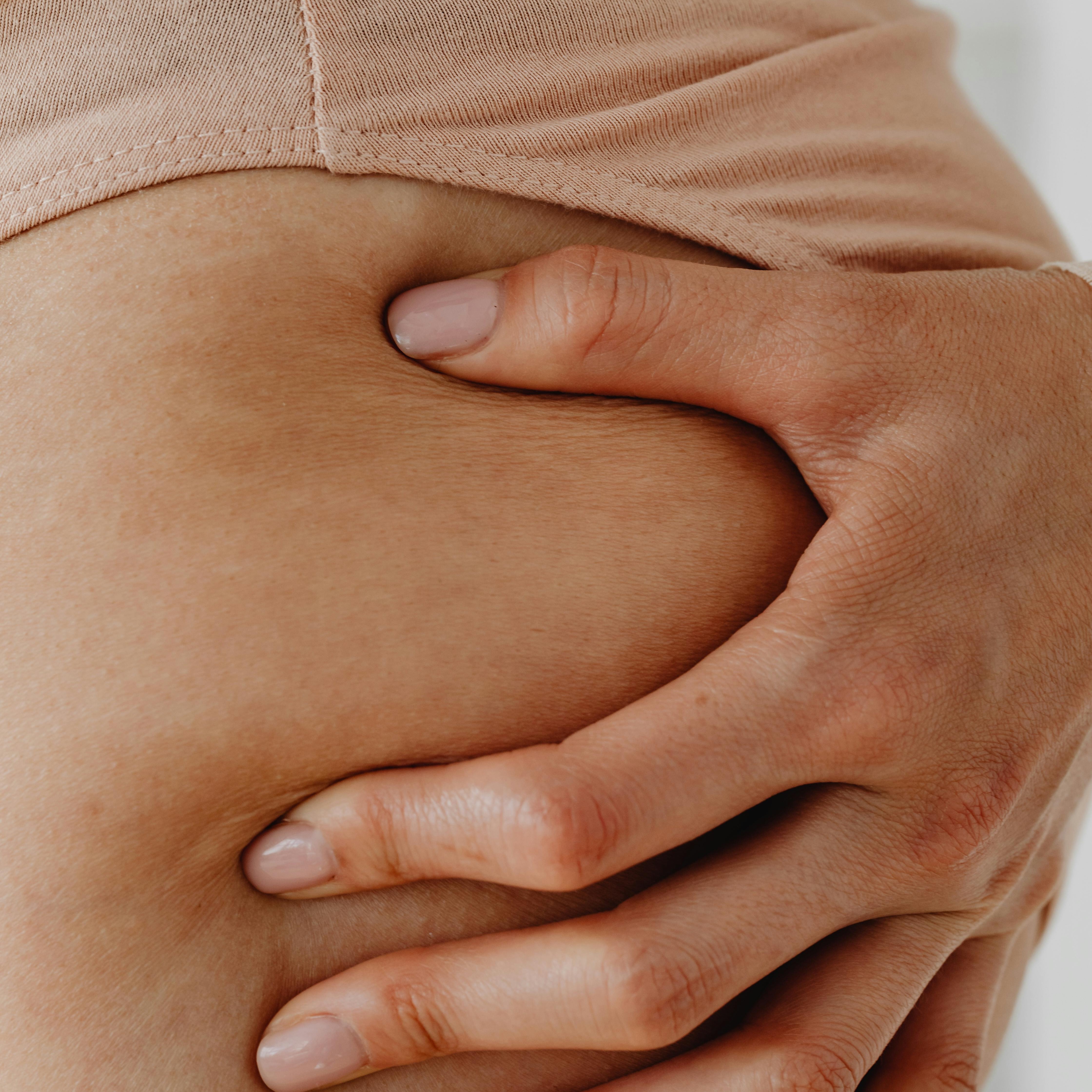 pexels-karolina-grabowska-8093130 Hautbereich mit Dehnungsstreifen, Hand, die sanft auf die Haut drückt, Bezug zu Hautpflege und Dehnungsstreifenbehandlung.
